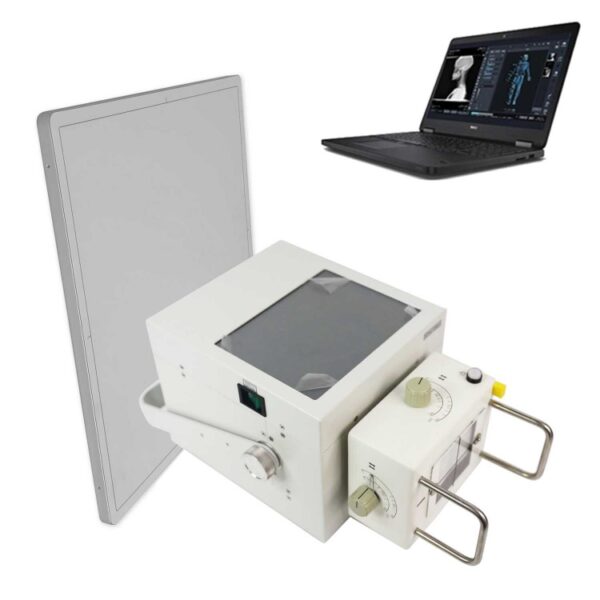 140mA Portable X Ray with Detector Laptop