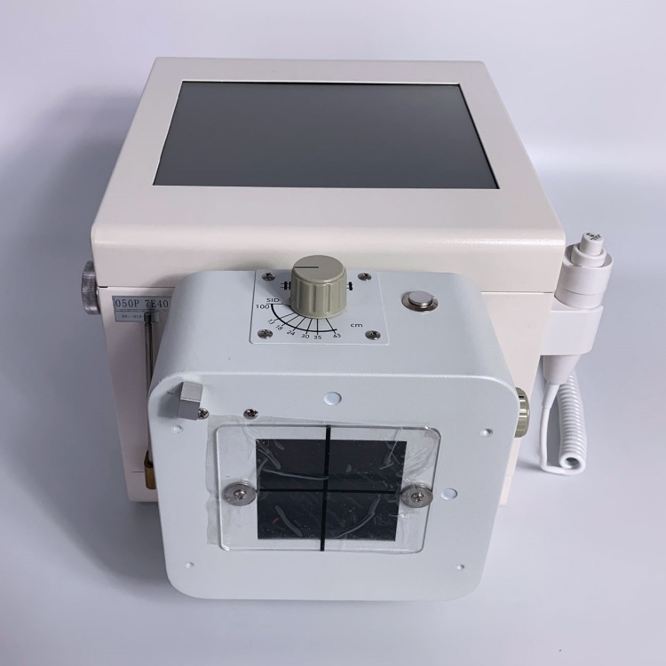 50ma portable x ray outlook