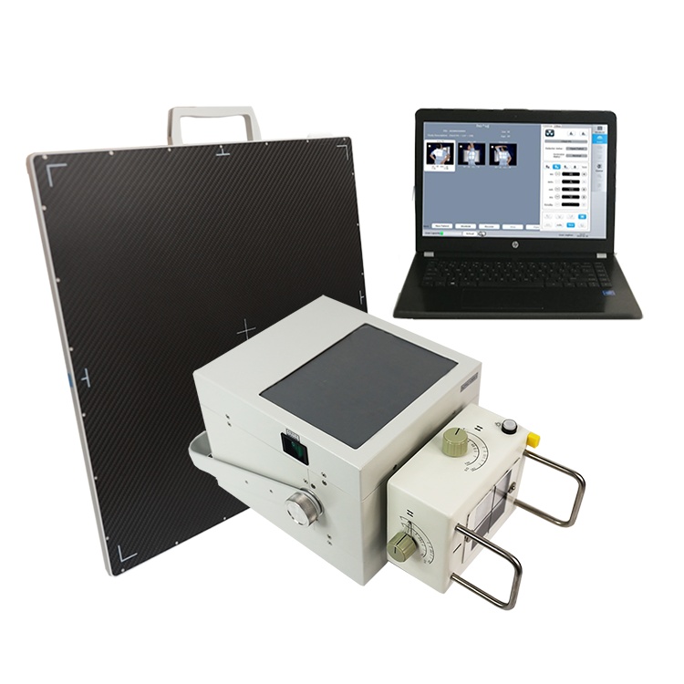 portable dr x ray with image software