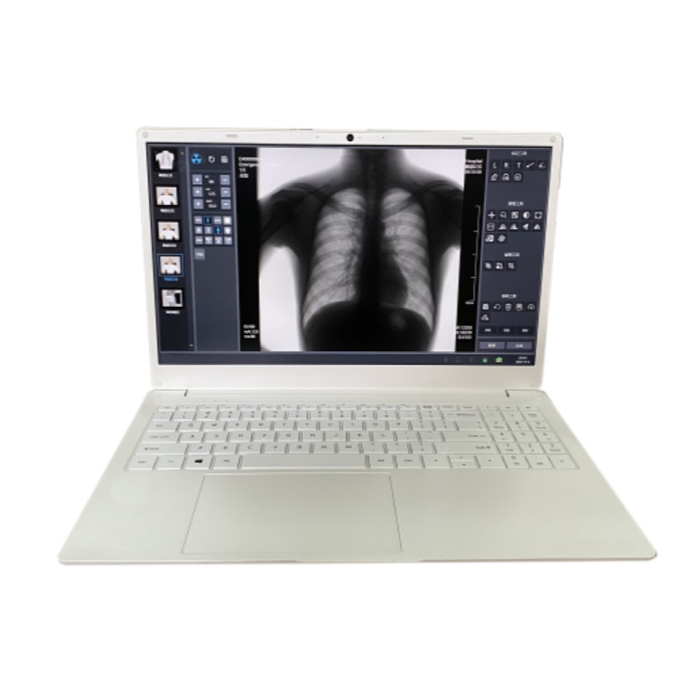 portable x ray machine with flat panel detector and laptop